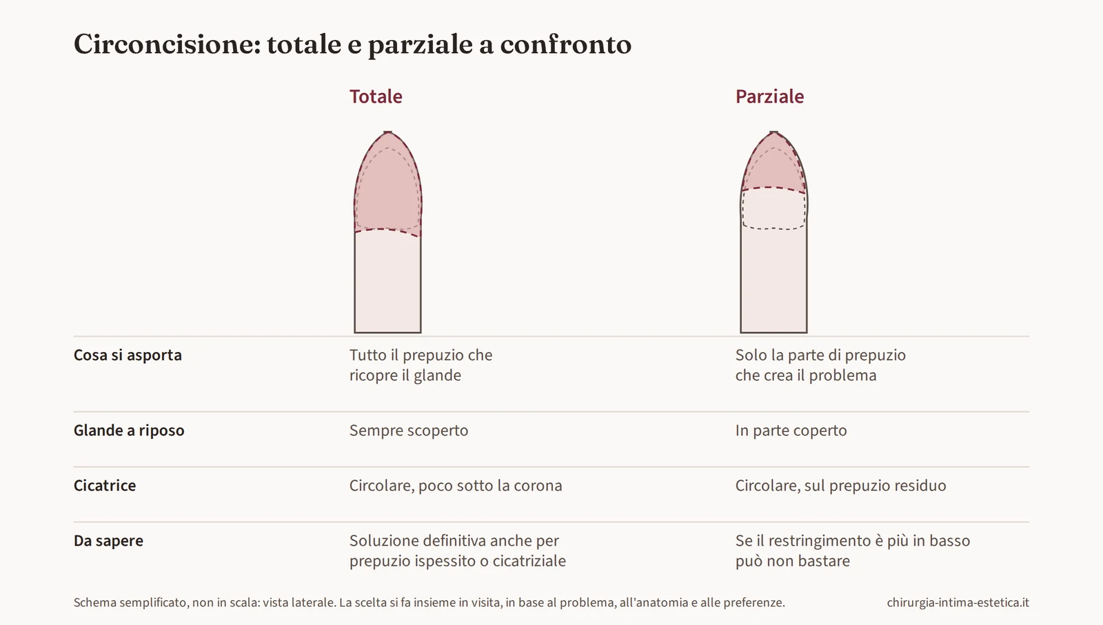 Schema di confronto tra circoncisione totale e parziale: quanta parte di prepuzio si asporta, glande a riposo, cicatrice
